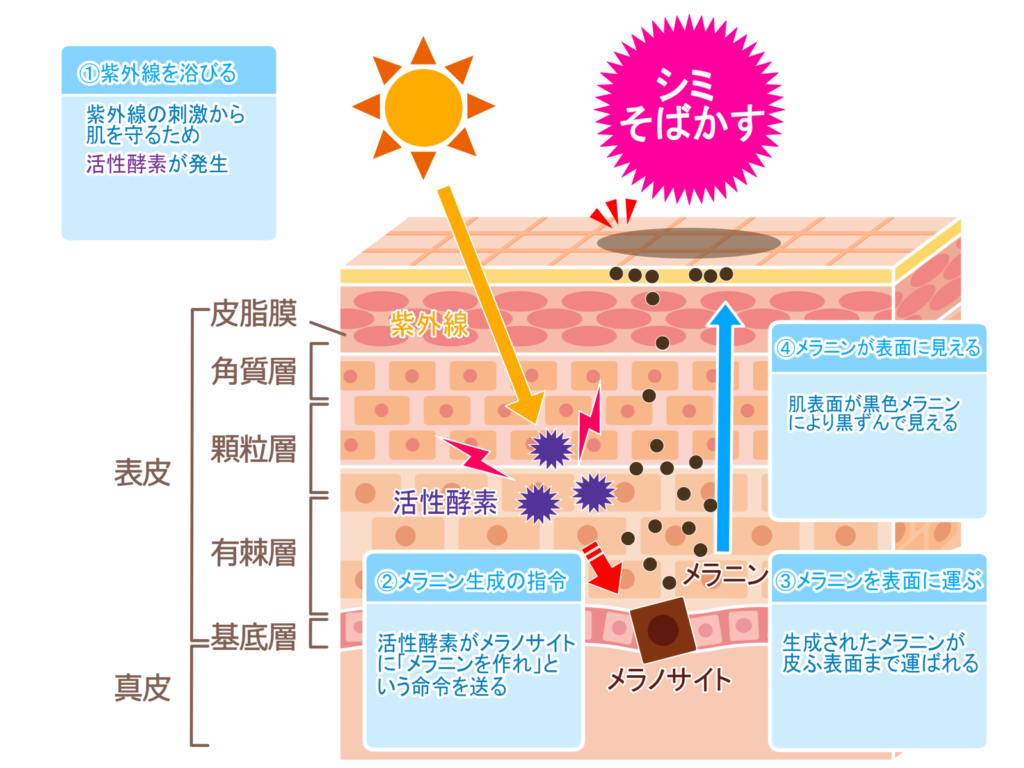 シミ　生成メカニズム